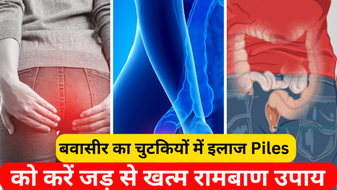 बवासीर का चुटकियों में इलाज Piles को करें जड़ से खत्म, रामबाण उपाय